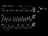 ekg2