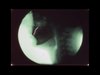 xray talking